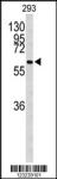 CDC73 Antibody (Center)