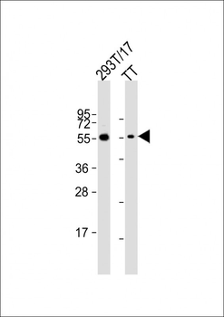 CDC73 Antibody (Center)