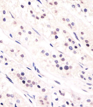 CDC73 Antibody (Center)