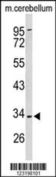 PXMP3 Antibody (Center)