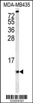 COX6A1 Antibody (Center)