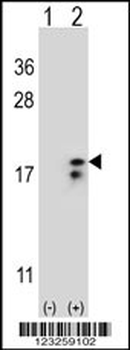 COX6A1 Antibody (Center)