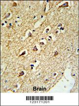 RPL18A Antibody (C-term)