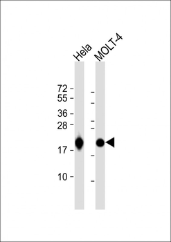 RPL18A Antibody (C-term)