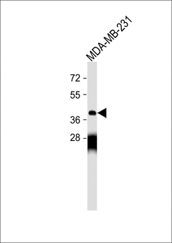OPRM1 Antibody (Center)