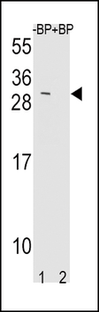 TIMP3 Antibody (Center)