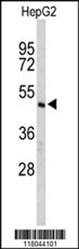 CFLAR Antibody (Center)