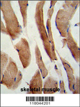 CFLAR Antibody (Center)