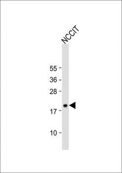HMGA1 Antibody (C-term)
