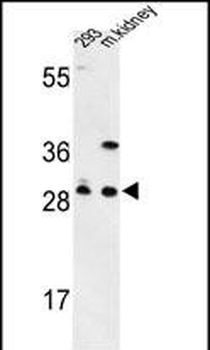 GCLM Antibody (C-term)