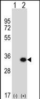 GCLM Antibody (C-term)