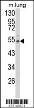 EFEMP1 Antibody (N-term)