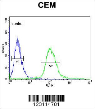 UTY Antibody (C-term)