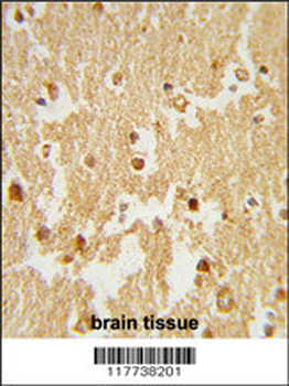 ESRRB Antibody (Center)