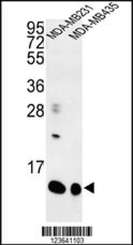 SPRR1B Antibody (C-term)