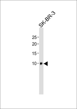 SPRR1B Antibody (C-term)