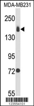 ITGA2 Antibody (C-term)