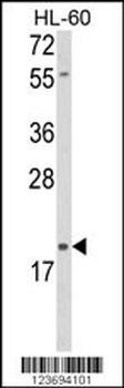 DLK2 Antibody (C-term)