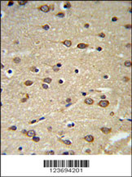 DLK2 Antibody (C-term)