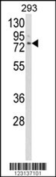 CLGN Antibody (Center)