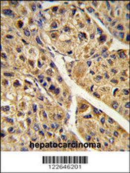 PEX11A Antibody (N-term)