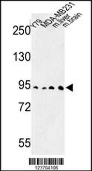 DPP10 Antibody (Center)