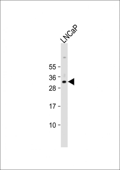 NKX3-1 Antibody (Center)