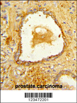 DAB2 Antibody (C-term)