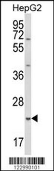 GSTA4 Antibody (N-term)