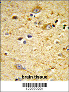 GSTA4 Antibody (N-term)