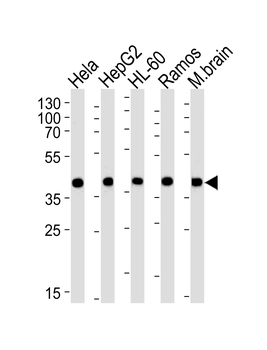 GOT2 Antibody (N-term)