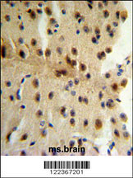 CLIP1 Antibody (N-term)