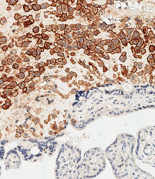 HLA-G Antibody (Center)