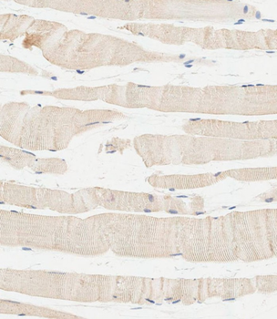 GC Antibody (Center)