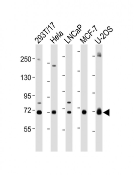 GC Antibody (Center)