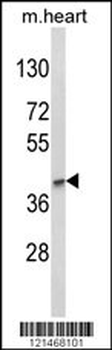 LMX1B Antibody (Center)