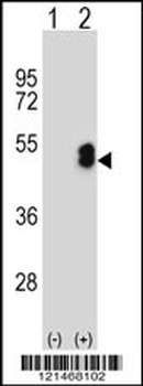 LMX1B Antibody (Center)