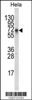 DTX1 Antibody (Center)