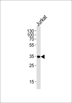 FCGR2A Antibody (C-term)