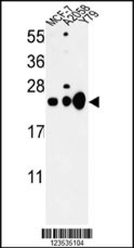 CBX1 Antibody (C-term)