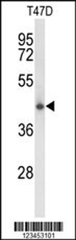 CLN5 Antibody (N-term)