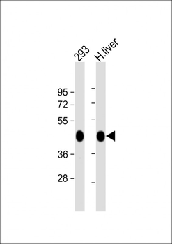 OAT Antibody (N-term)