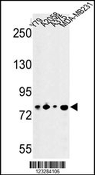 CSRP2BP Antibody (Center)