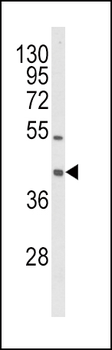 OLR1 Antibody (Center)