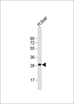 QDPR Antibody (C-term)