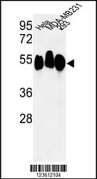 RBBP7 Antibody (N-term)