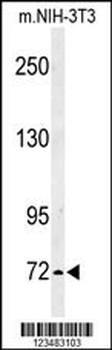 IL1RAPL2 Antibody (Center)