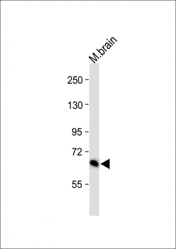 GLS Antibody (C-term)