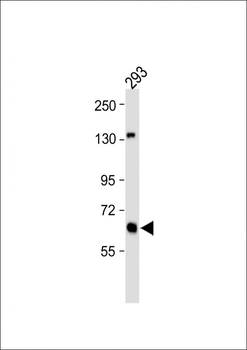 GLS Antibody (C-term)