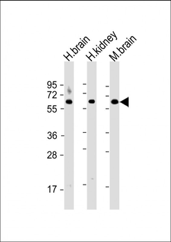 GLS Antibody (C-term)